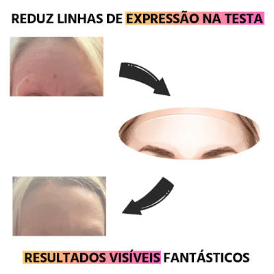 Adesivos de Silicone Anti Rugas Reutilizável